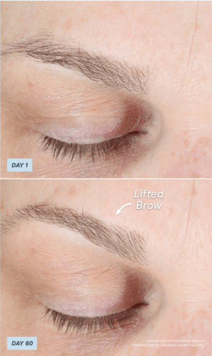 Avant/après du sourcil après le soin de 60 jours avec le NuFACE Trinity