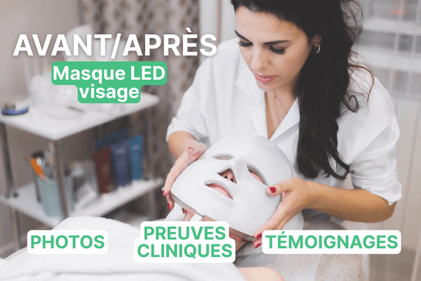 Avant après masque LED visage