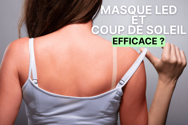 Masque LED et coup de soleil