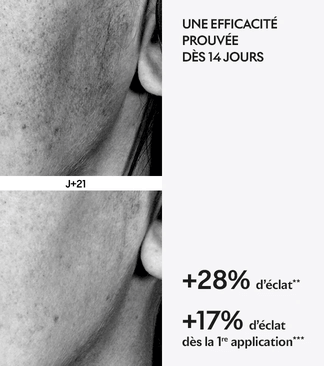 Avant après protocole Brightening de Lightinderm
