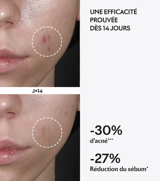 Avant après protocole Purity de Lightinderm