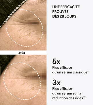 Avant après protocole Repair de Lightinderm