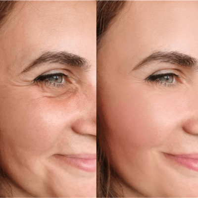 Avant après Twenty DC