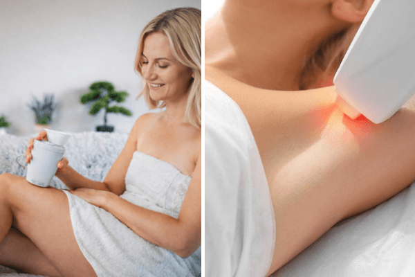 Épilation laser et lumière pulsée : les vraies différences pour choisir la bonne méthode