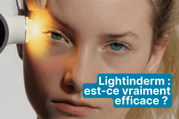 Avis Lightinderm : est-ce vraiment efficace ? Mon retour honnête