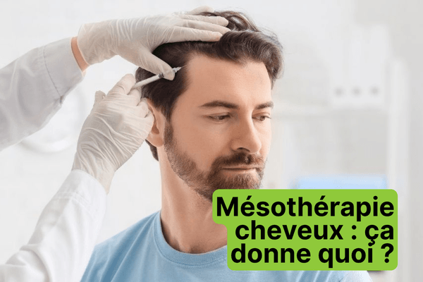 Mésothérapie cheveux : ce que ça fait vraiment (et ce que ça ne fait pas)