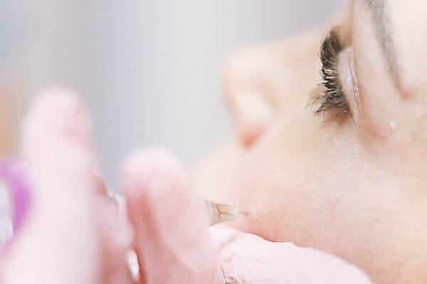 Mésothérapie : quels sont les vrais dangers à connaître avant de vous lancer ?