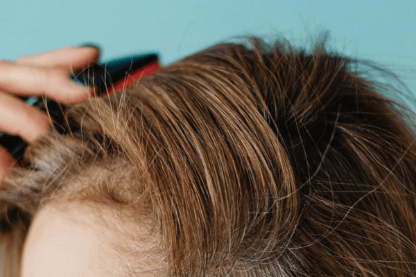 Microneedling cheveux à domicile : le guide complet pour bien commencer (et éviter les erreurs)