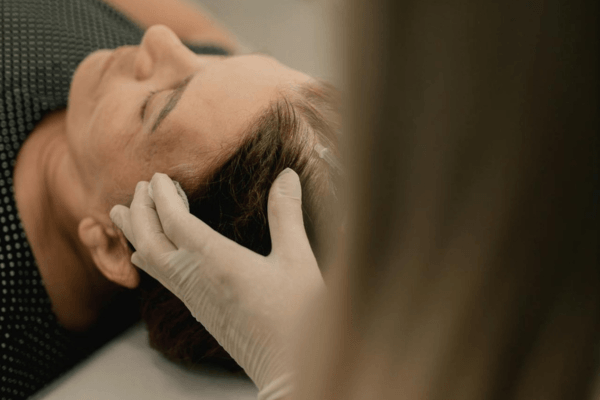 Microneedling cheveux : ce que la science dit vraiment (et comment bien le pratiquer)