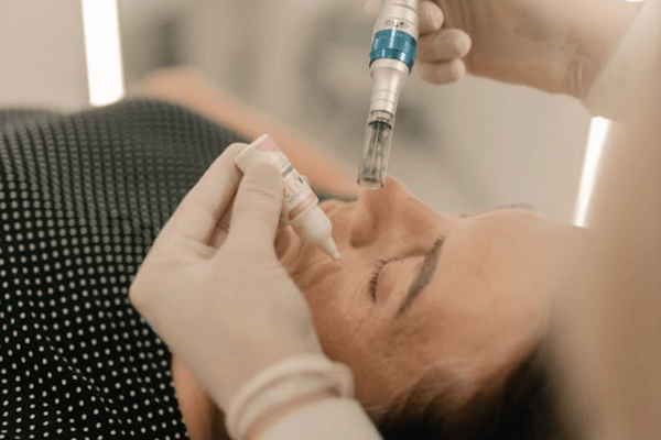 Microneedling : comment ça marche, ce que ça change vraiment pour la peau (et ce que personne ne vous dit)