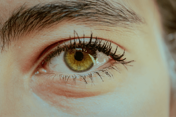 Paupière tombante : tout comprendre pour retrouver un regard ouvert