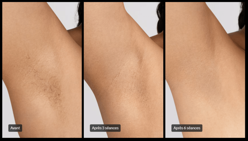 Résultats du Braun Silk Expert Pro 5