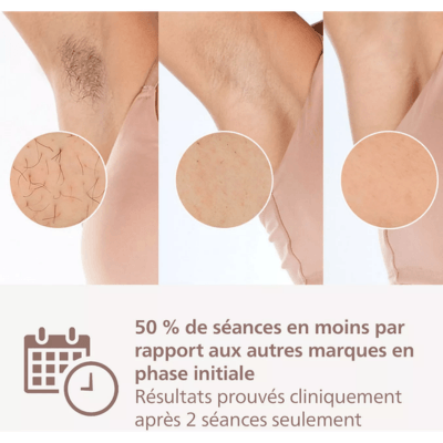 Résultats du Philips Lumea 7000