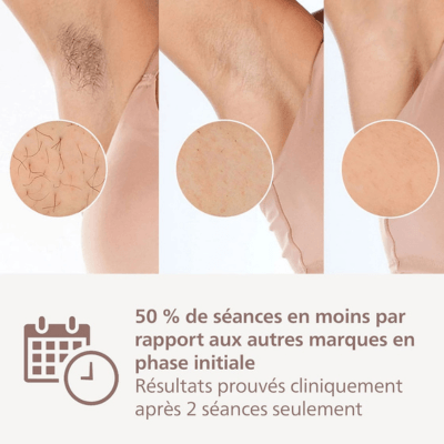 Résultats du Philips Lumea 8000