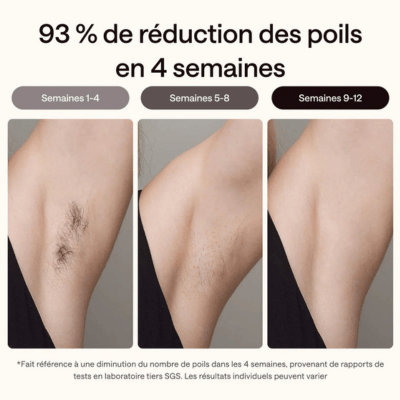 Résultats sur 4 semaines d'Ulike Air 3
