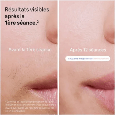 Résultats lèvres Braun Skin i·expert PL7249