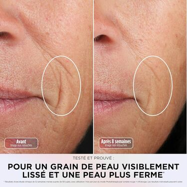 Masque Shark CryoGlow pour lisser la peau
