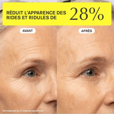 Avant/après Ziip halo
